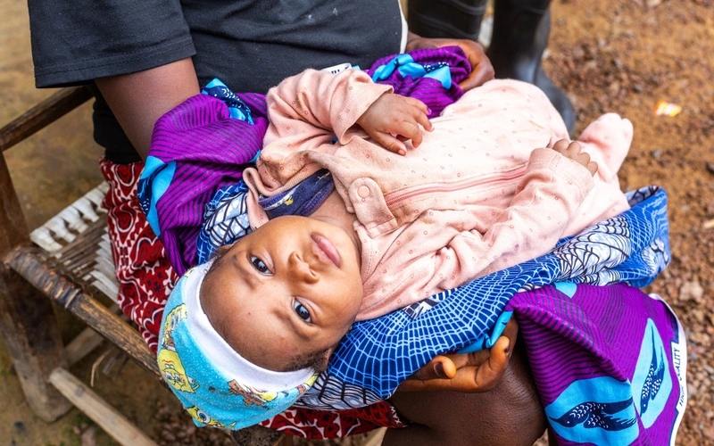 Rose sits quietly on her mother Annie Sackie’s lap after receiving the oral polio vaccine during a door-to-door immunization campaign in Bong County, Liberia, on July 30, 2025.